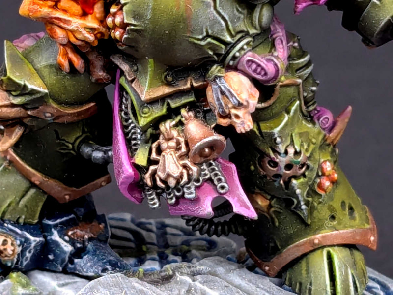 Typhus